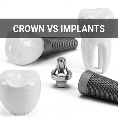 Visit our Crowns vs. Implants page