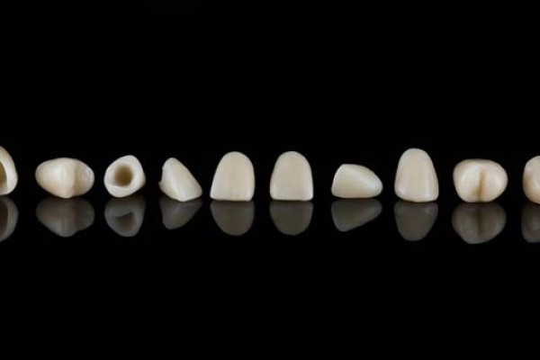 Everything You Need To Know About Dental Crowns