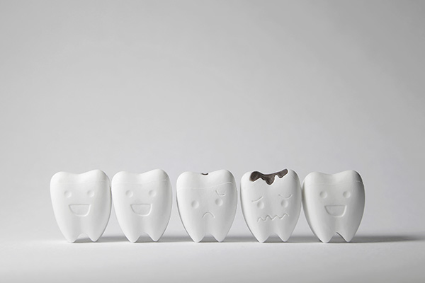 How a General Dentist Can Treat Tooth Decay from Texas Implant & Dental Specialists in Plano, TX