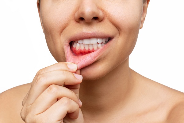 When To Seek Gum Disease Treatment From A Periodontist