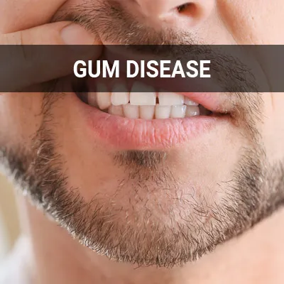 Visit our Gum Disease page