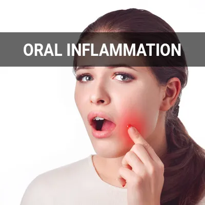 Visit our Oral Inflammation page
