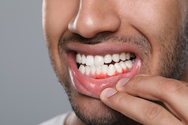 Ask A Periodontist: What Are Risk Factors For Gum Disease?