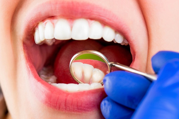 FAQs About Scaling And Root Planing From A Periodontist