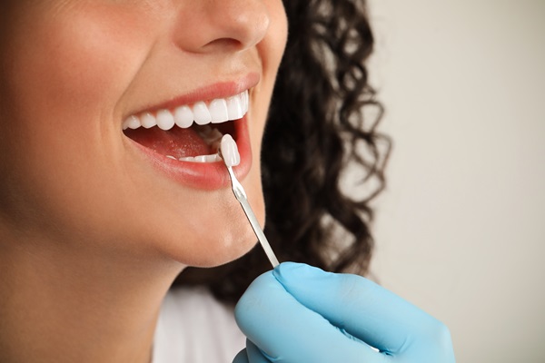 Dental Veneers As Part Of A Smile Makeover